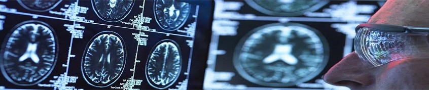 神經(jīng)干細(xì)胞移植的過程 神經(jīng)干細(xì)胞移植的過程