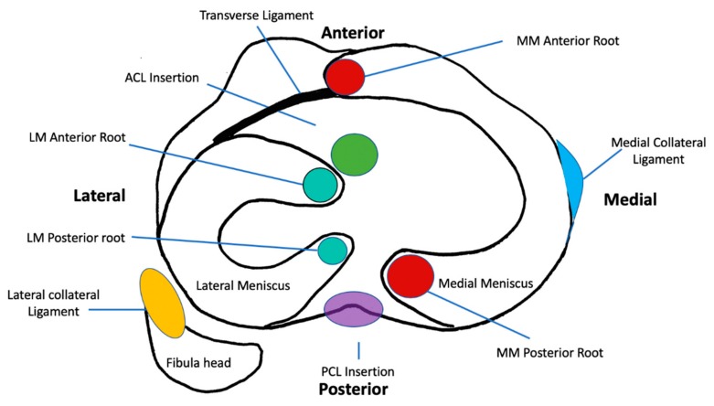 圖1：脛骨平臺水平的軸向截面示意圖，描繪了半月板的解剖結構、附件和關系