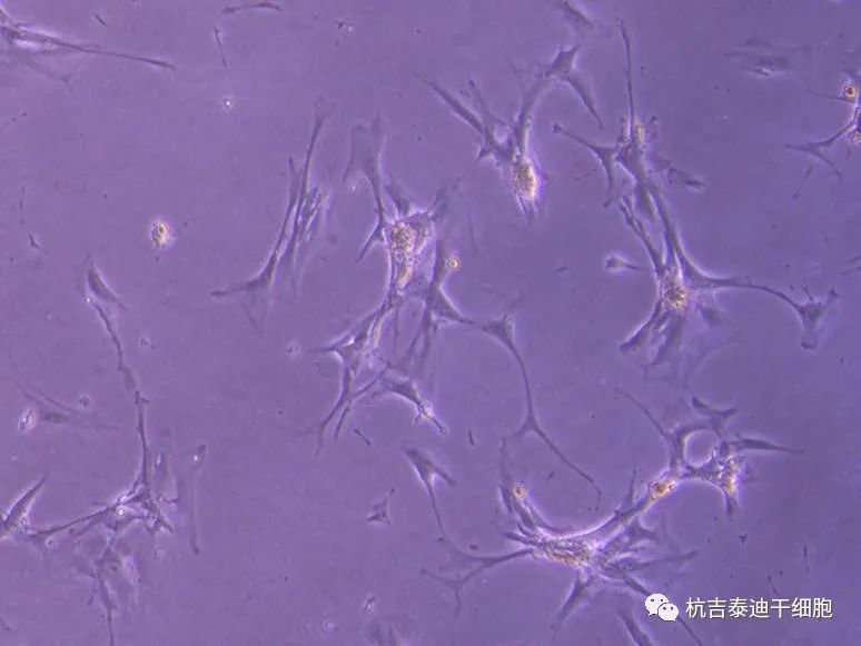 可能的腎臟干細胞,在實驗室中生長