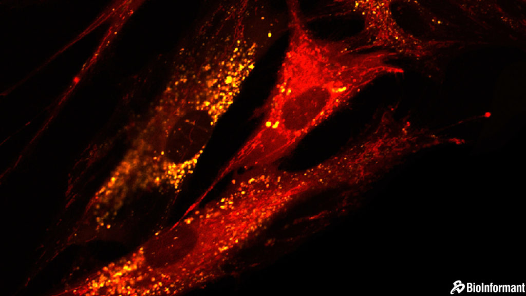 干細胞的好處| 間充質干細胞 (MSC) 相對于其他干細胞類型的優勢 干細胞的好處| 間充質干細胞 (MSC) 相對于其他干細胞類型的優勢