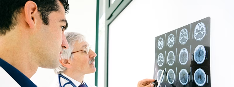 中風(fēng)期間會(huì)發(fā)生什么?癥狀、后果和治療方案是什么? 中風(fēng)期間會(huì)發(fā)生什么?癥狀、后果和治療方案是什么?