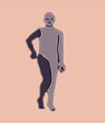 這種類型的腦癱表現(xiàn)為四肢僵硬。