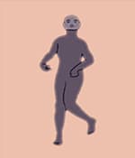 運動障礙型腦癱涉及過度的不自主運動。
運動障礙性腦癱的類型
肌張力障礙：僵硬和松弛交替出現(xiàn)，
舞蹈徐徐樣腦癱：持續(xù)的不自主運動導致姿勢異常。