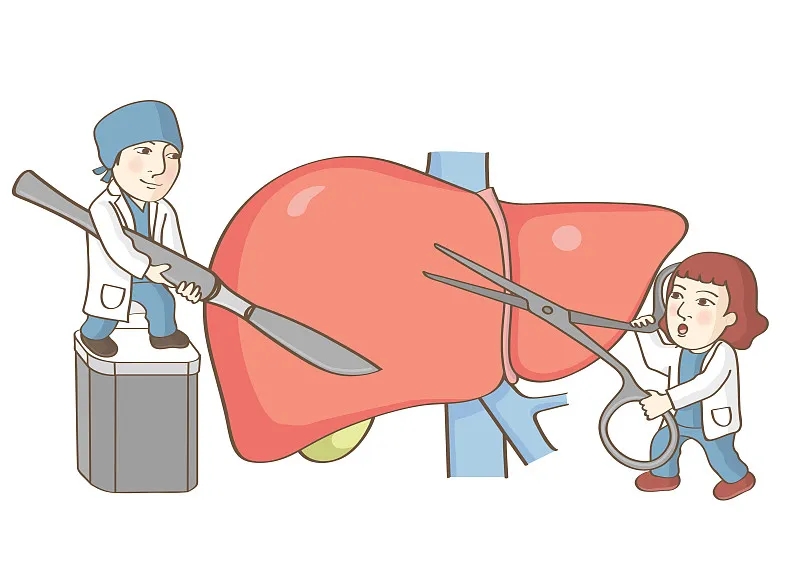 關于肝移植的事實 關于肝移植的事實