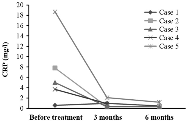 圖4:每位患者治療前后的CRP水平。1名患者的CRP水平降低,而其他4名患者的CRP水平保持穩定并在正常范圍內。 圖4:每位患者治療前后的CRP水平。1名患者的CRP水平降低,而其他4名患者的CRP水平保持穩定并在正常范圍內。