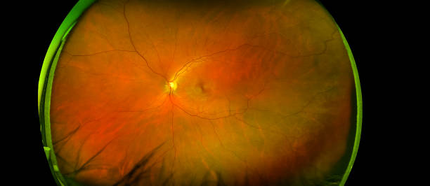 北大人民醫院眼科研究所:干細胞治療遺傳性視網膜疾病研究看點 北大人民醫院眼科研究所:干細胞治療遺傳性視網膜疾病研究看點