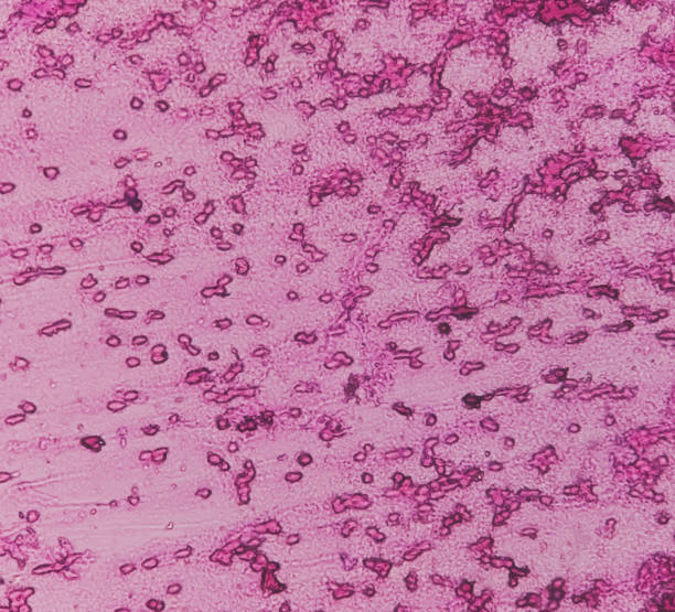 人羊膜上皮細(xì)胞對(duì)中樞神經(jīng)系統(tǒng)損傷和疾病的治療潛力