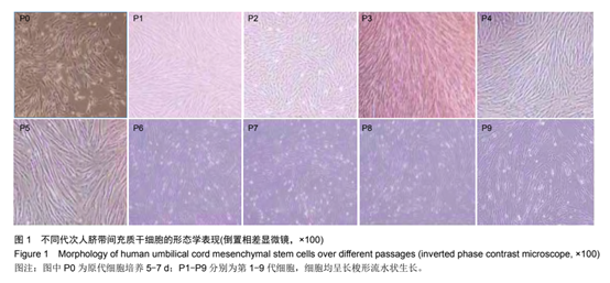不同代次人臍帶問(wèn)充質(zhì)于細(xì)胞的形態(tài)學(xué)表現(xiàn) 不同代次人臍帶問(wèn)充質(zhì)于細(xì)胞的形態(tài)學(xué)表現(xiàn)