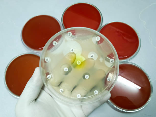 骨髓移植成功率100％嗎？