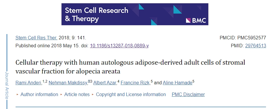 使用人類(lèi)自體脂肪基質(zhì)血管成分成體細(xì)胞治療斑禿的臨床研究綜述 使用人類(lèi)自體脂肪基質(zhì)血管成分成體細(xì)胞治療斑禿的臨床研究綜述