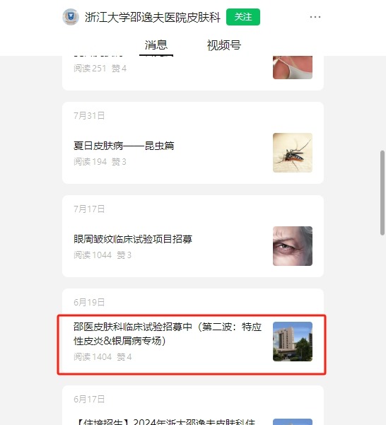 干細胞臨床招募:邵逸夫醫(yī)院招募特應性皮炎濕診患者參與治療! 干細胞臨床招募:邵逸夫醫(yī)院招募特應性皮炎濕診患者參與治療!