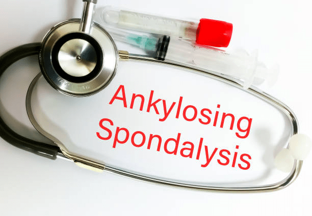 2019-2024年干細胞治療強直性脊柱炎臨床研究進展 2019-2024年干細胞治療強直性脊柱炎臨床研究進展