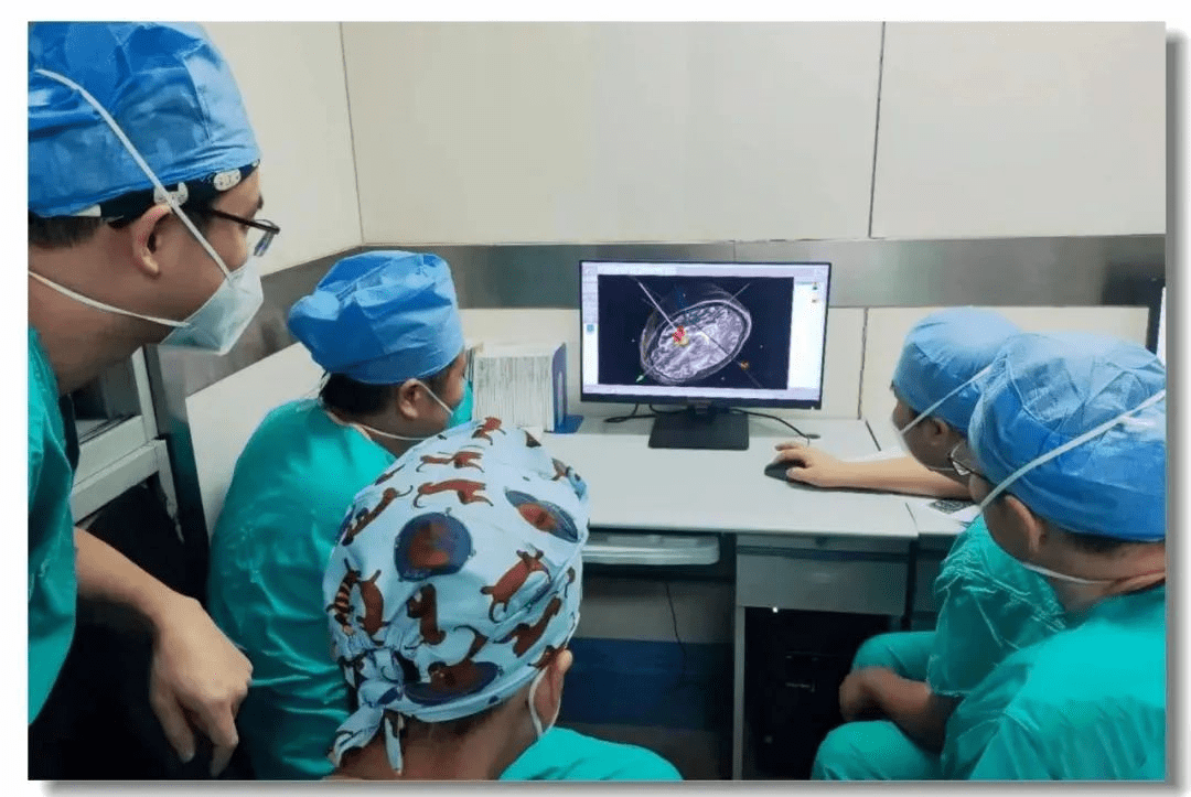 立體定向引導(dǎo)下神經(jīng)干細(xì)胞移植術(shù)