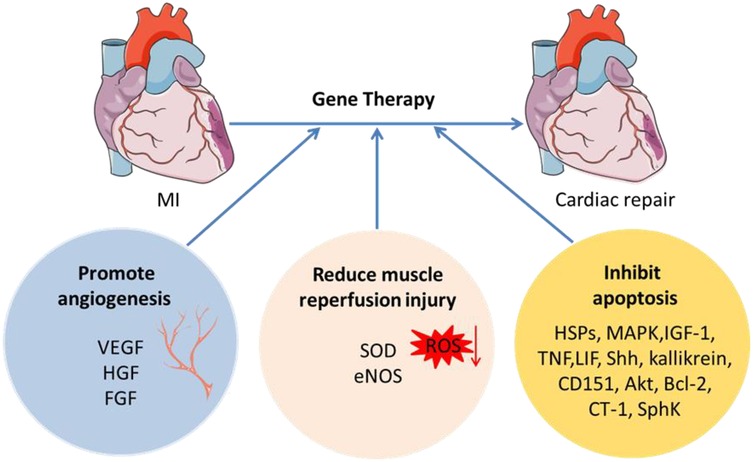 圖2:MI基因治療示意圖。 圖2:MI基因治療示意圖。