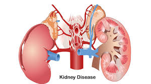 減輕負擔,延長生命:干細胞療法對降低腎病透析并發癥的影響評估 減輕負擔,延長生命:干細胞療法對降低腎病透析并發癥的影響評估