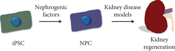 腎臟疾病中的 iPSC 衍生腎細(xì)胞 腎臟疾病中的 iPSC 衍生腎細(xì)胞