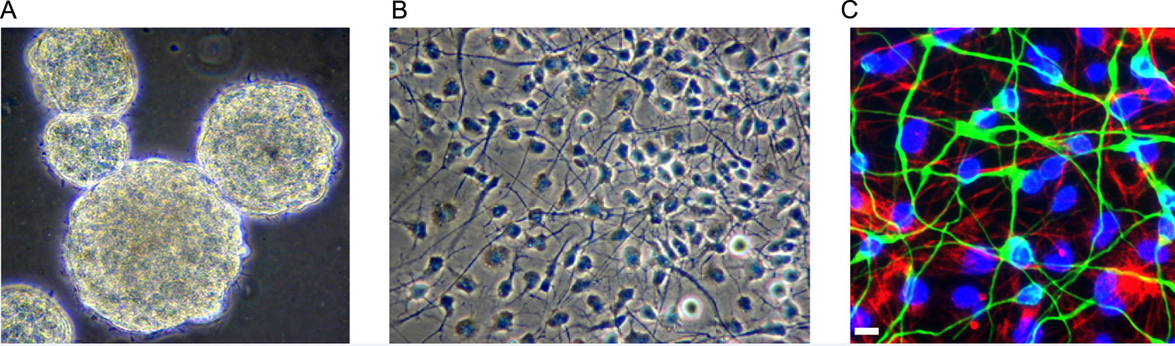 圖1：人類胎兒腦源性神經(jīng)干細胞。