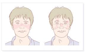 2025年1-10月干細胞治療系統性紅斑狼瘡匯總:多項臨床試驗全面提速! 2025年1-10月干細胞治療系統性紅斑狼瘡匯總:多項臨床試驗全面提速!