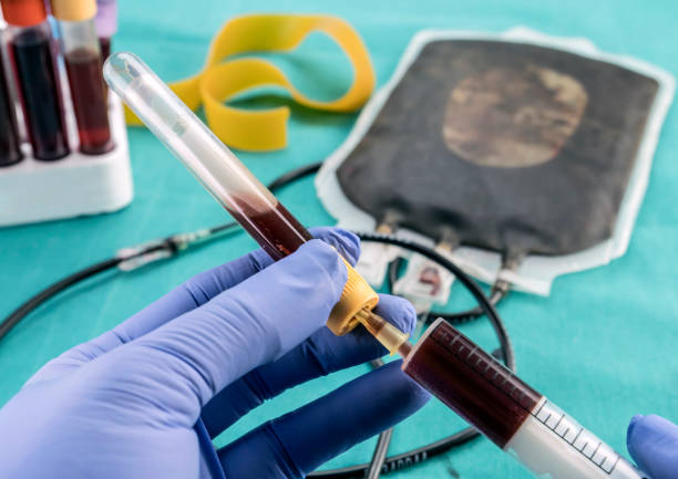 自體干細胞移植費用及副作用:三大客觀視角下的真相 自體干細胞移植費用及副作用:三大客觀視角下的真相