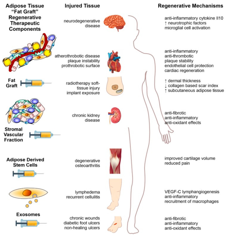 圖2：本文以示意圖形式概述了利用脂肪組織脂肪治療人類疾病的方法。