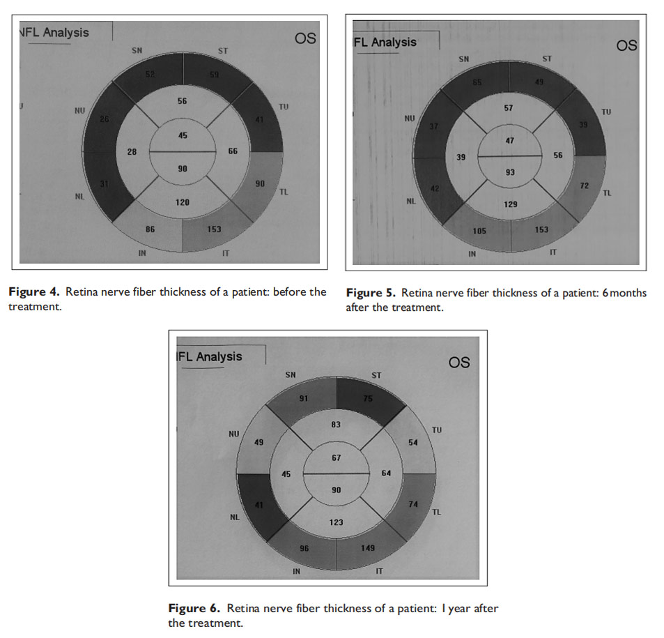 視神經萎縮臨床試驗 視神經萎縮臨床試驗